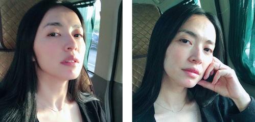 星星痘痘贴明星网红,明星网红的痘痘贴秘籍